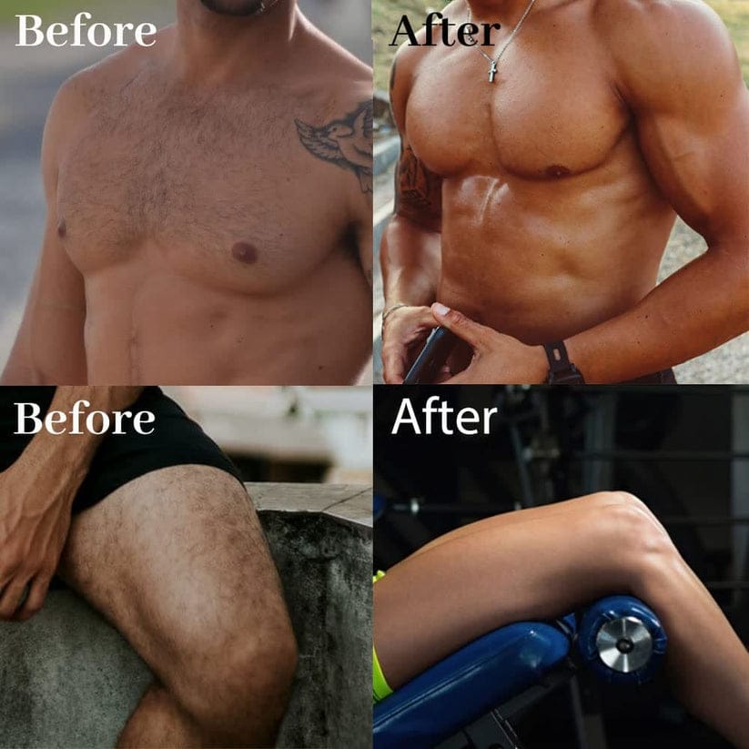 Ecrin Hair Removal Spray For Men And Women 150 ML