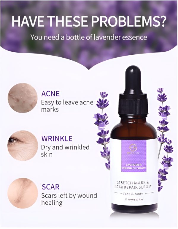 Estelin Stretch Mark & Scar Repair Serum 30ml